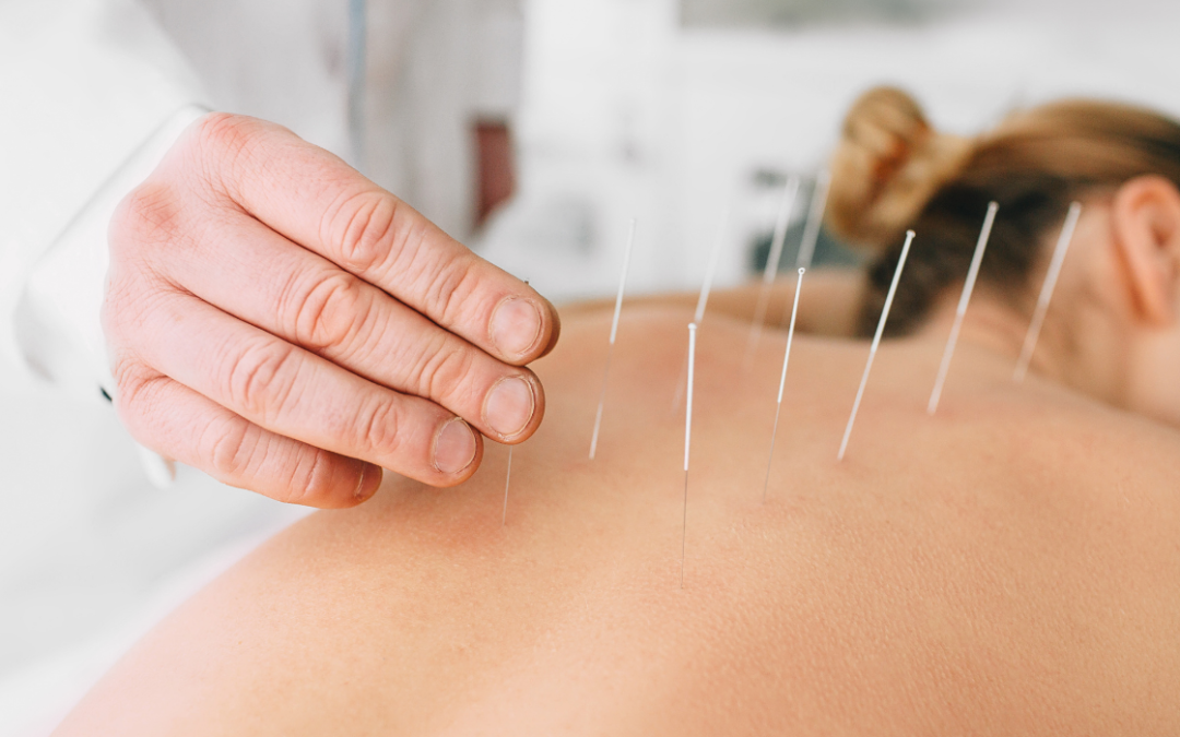 Can Acupuncture help with Winter Aches and Pains