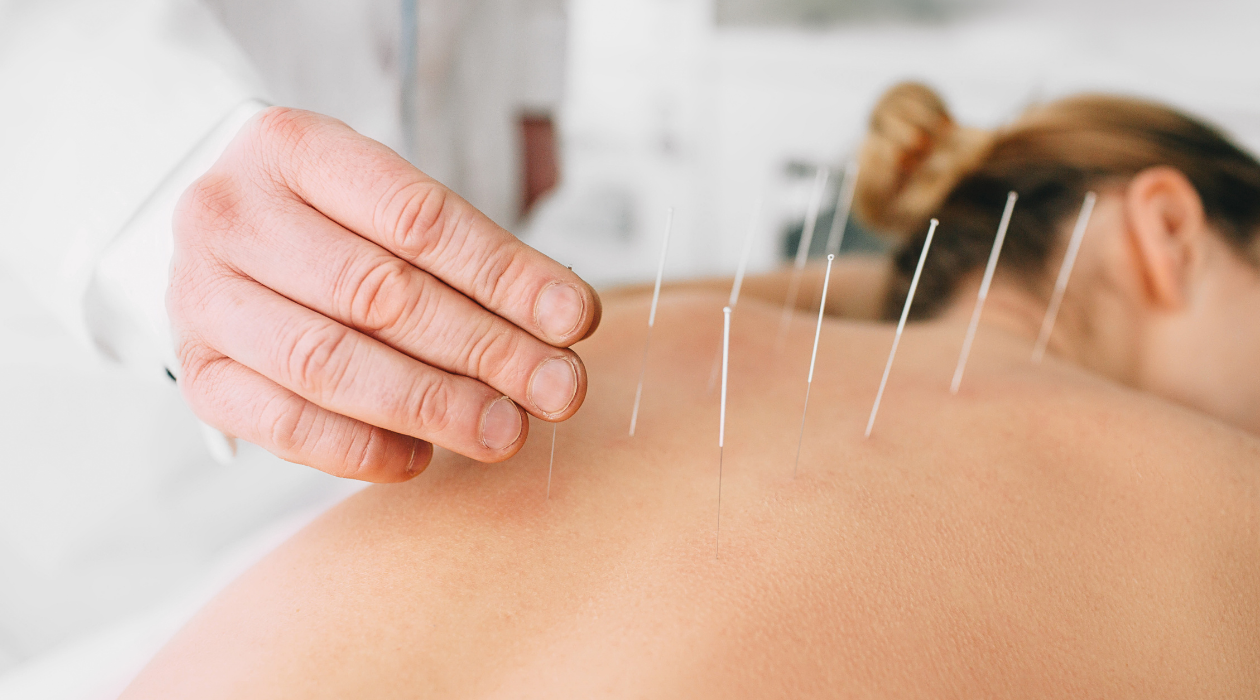 Photo for acupuncture blog