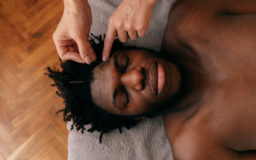 Acupuncture for Migraine and Headaches: Treatment and Prevention