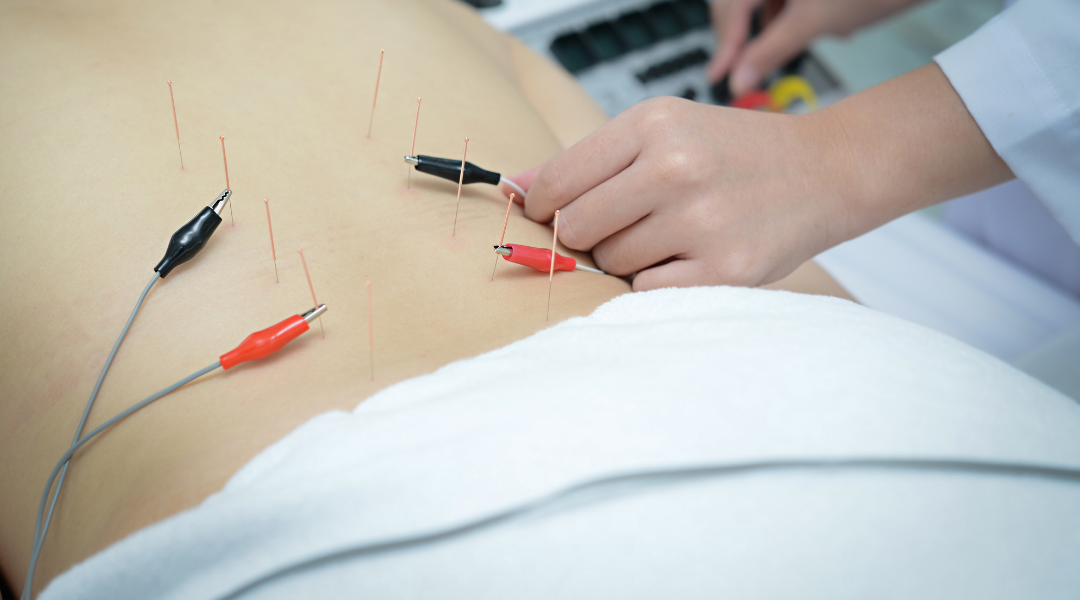 Jump Starting the Body with Electroacupuncture