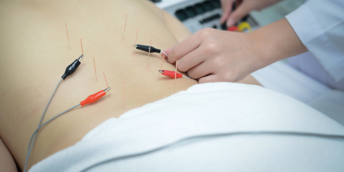 Electroacupunture at the Natural Health Center of Clifton